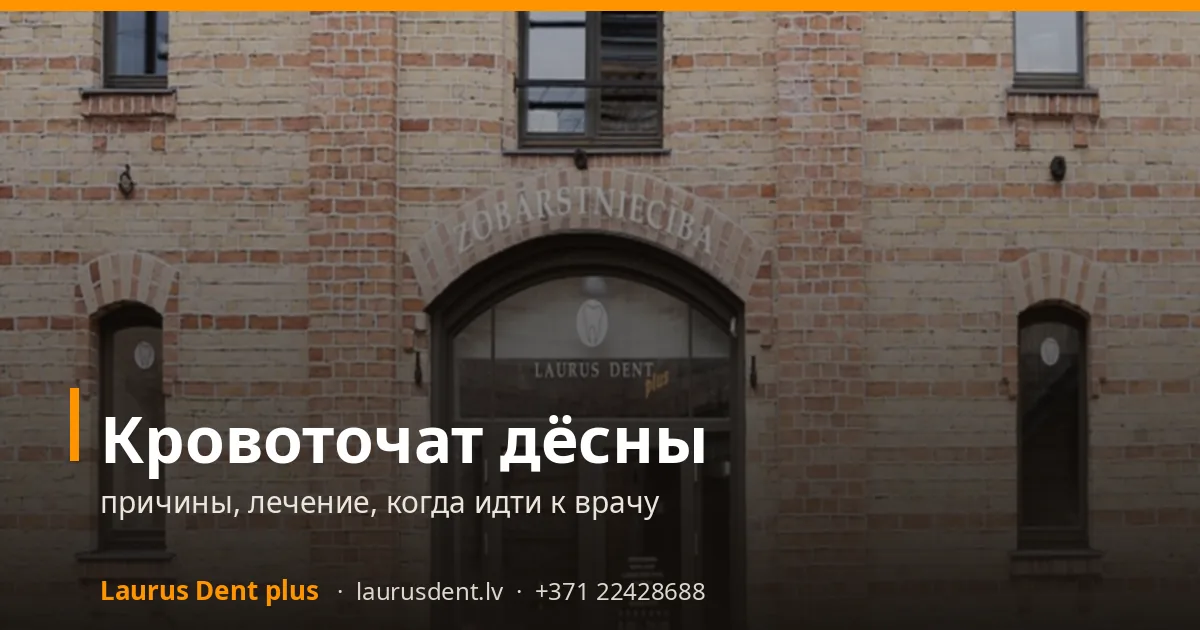 Кровоточат дёсны: причины, лечение, когда идти к врачу