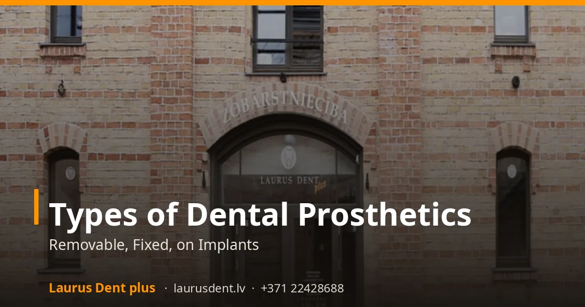 Types of Dental Prosthetics: Removable, Fixed, on Implants