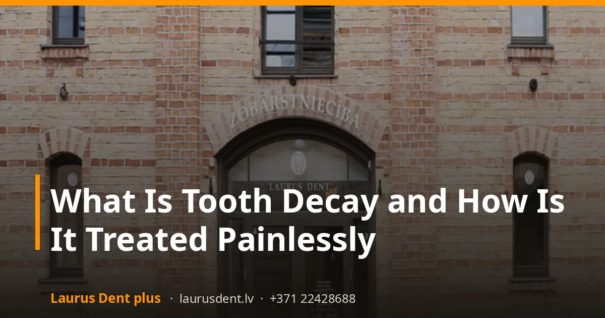 What Is Tooth Decay and How Is It Treated Painlessly