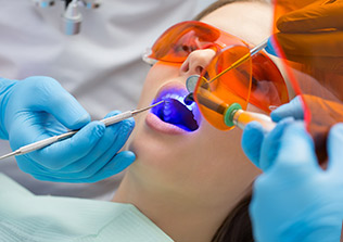 Dental filling