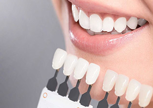 Teeth whitening